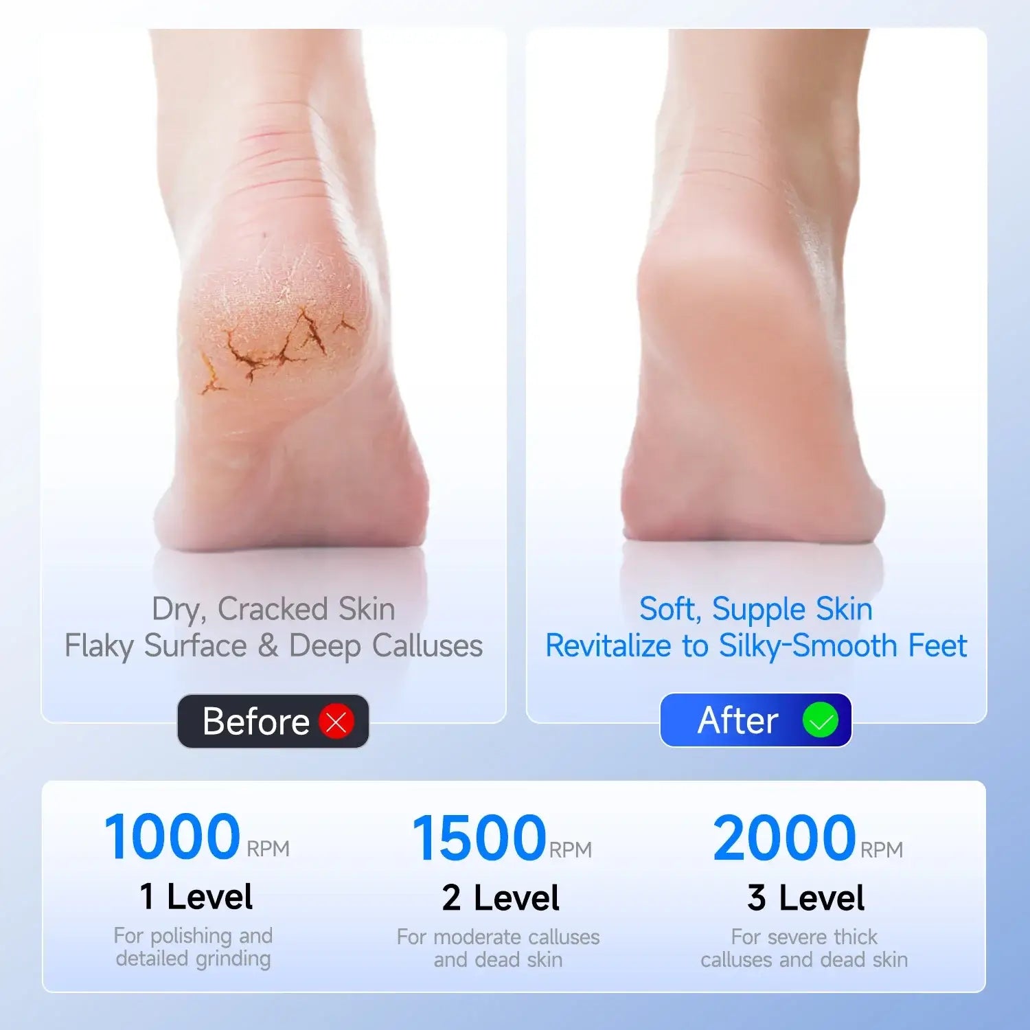 Callus Remover for Feet with Extra Grinding Heads